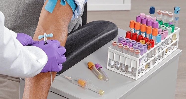 Verinäytteenotto ja värikoodattuja laboratorioputkia tutkimuksia varten